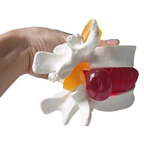 Хит 1 шт. анатомический Поясничный диск для грыжи поясничного отдела