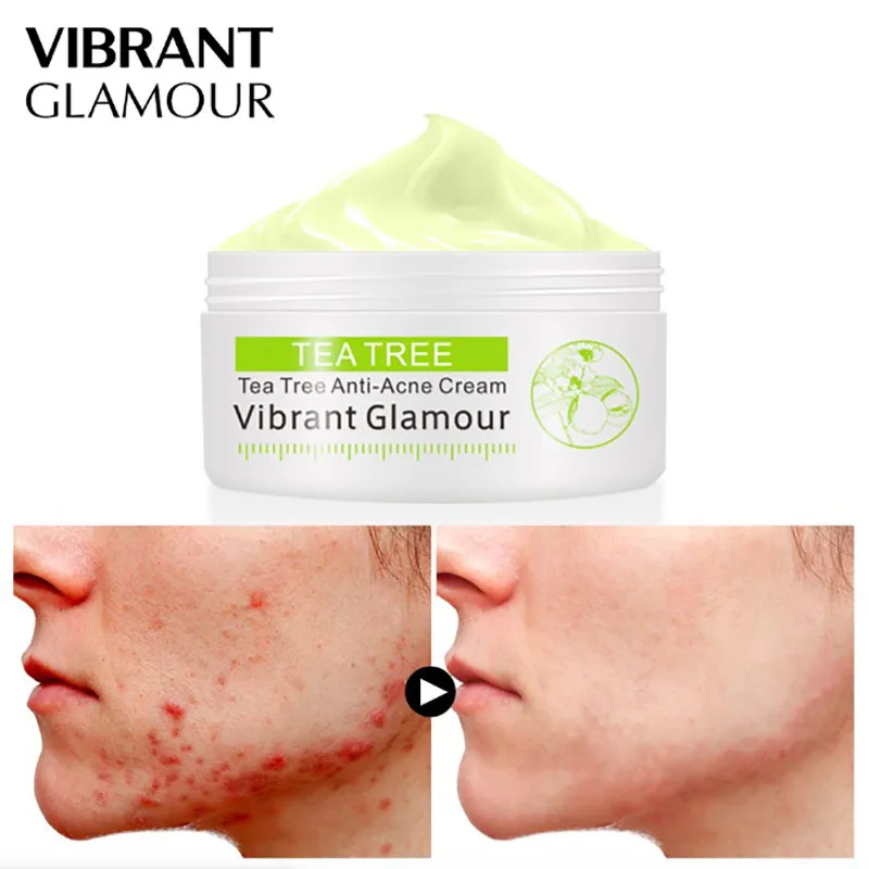 Крем для лица чайное дерево крем удаления шрамов от акне ухода за кожей