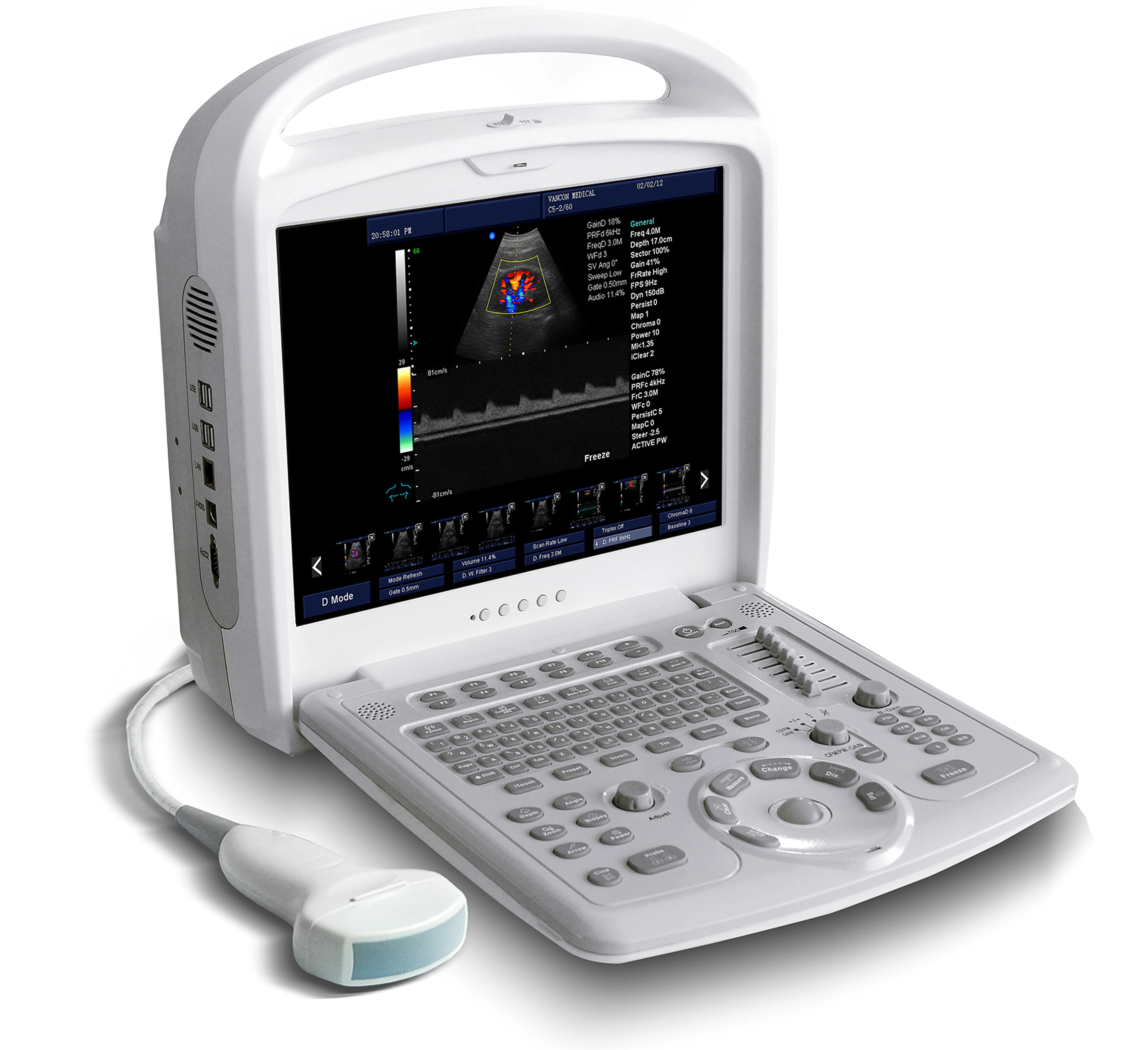 HOT selling portable MINDRAY color doppler ultrasound 4D machine price