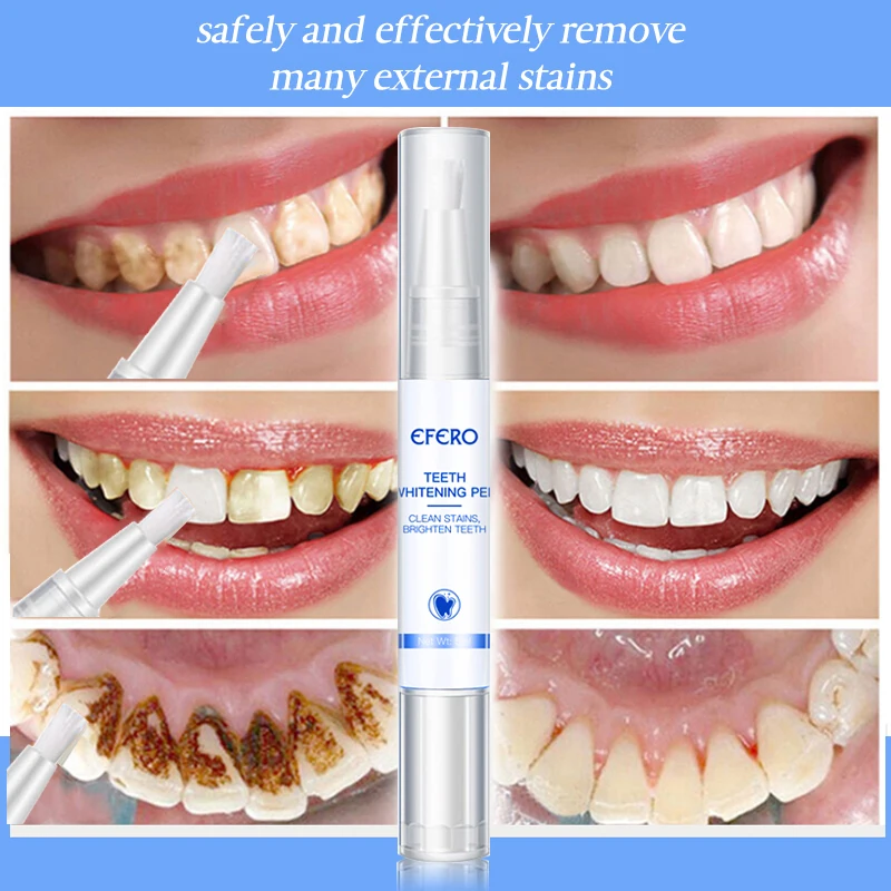 

White Teeth Whitener Toothpaste Teeth Whitening Pen Bad Breath Care Cleaning Plaque Tartar Stain Removal Dental Oral Care