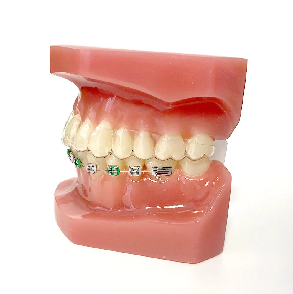 1 ~ 10 шт. невидимые металлические кронштейны высокого качества