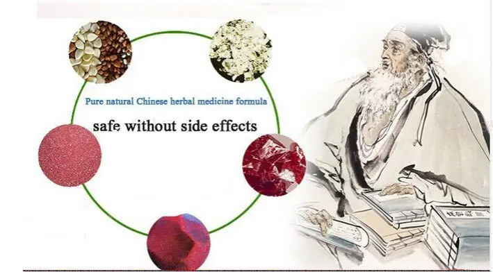 ZB геморрой мазь растительный травяной материал мощный крем от геморроя