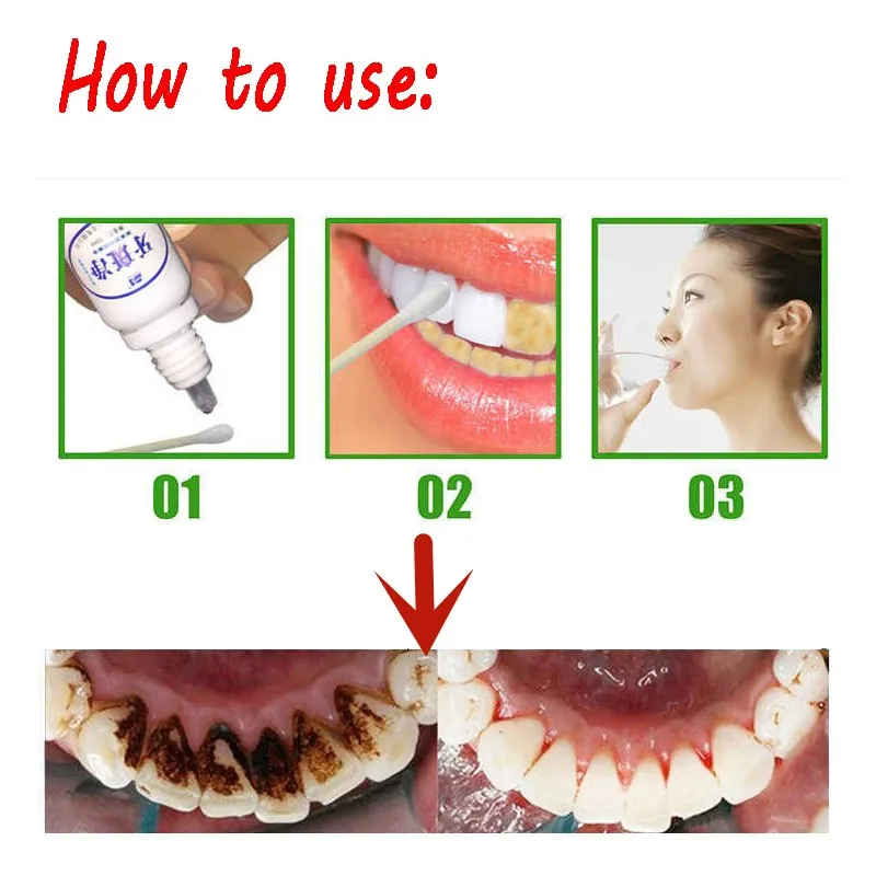 

10ml Teeth Whitening Water Oral Hygiene Cleaning Teeth Care Tooth Cleaning Whitening Water Clareamento Dental Odontologia