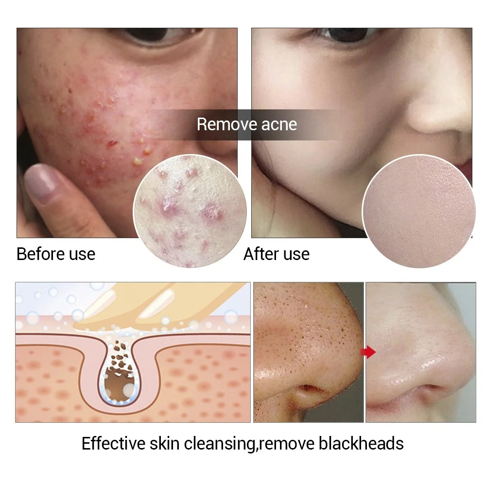 Мыло ручной работы с эфирным маслом чайного дерева LANBENA увлажняющее глубокое