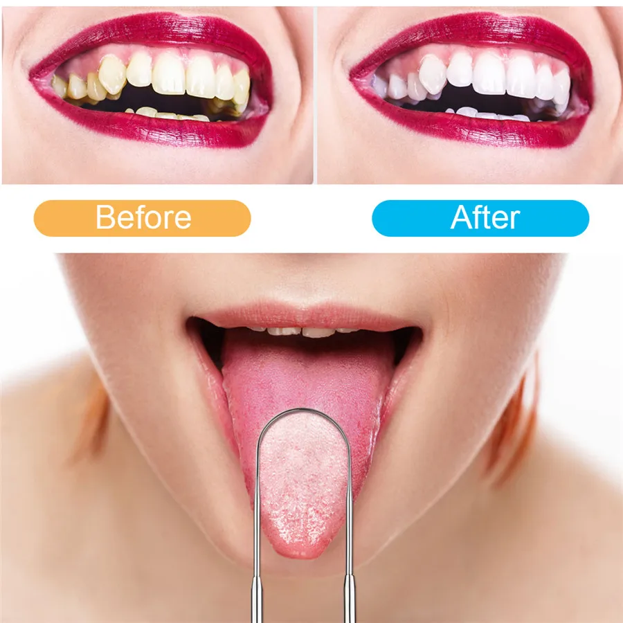 Electric Sonic Oral Irrigator Dental Scaler Tooth Calculus USB Rechargeable Teeth Health Hygiene | Бытовая техника