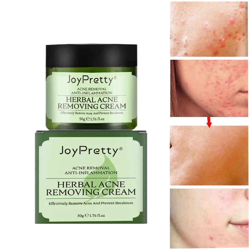 

JoyPretty Herbal Acne Removal Cream Acne Treatment Fade Acne Spots Oil Control Face Care Moisturizing Facial Skin Care Cosmetic