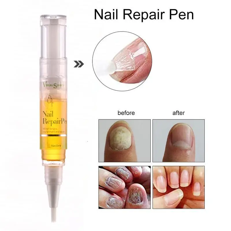 1 шт. ручка для лечения грибков ногтей против грибковой инфекции биологический