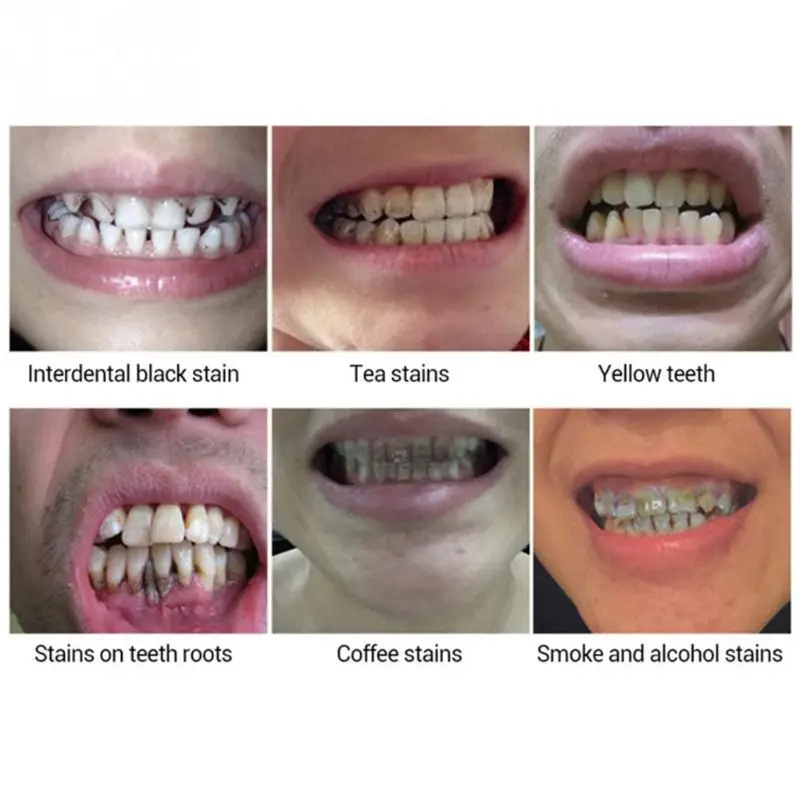 Отбеливание гигиены полости рта Очищающая Сыворотка для зубов удаляет пятна