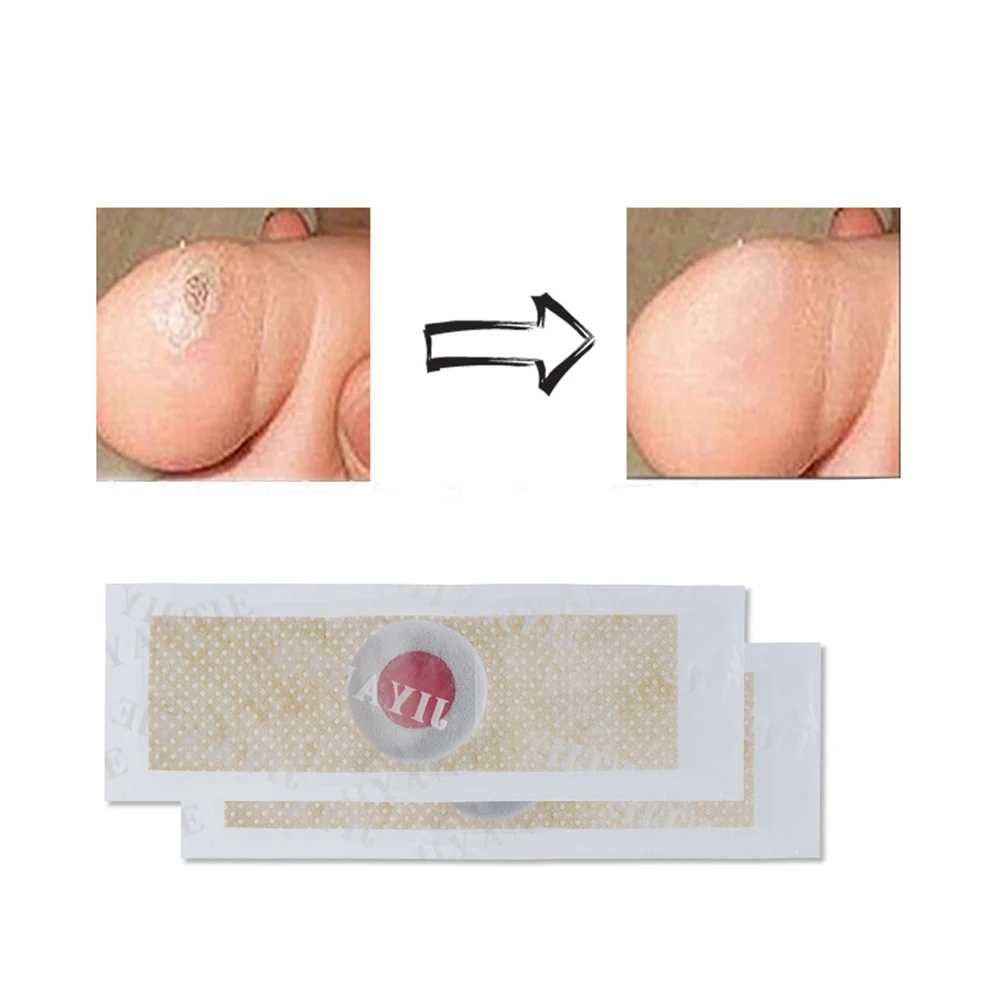 Новинка 2019 42 шт./коркор. пластырь для удаления мозолей и бородавок на ногах