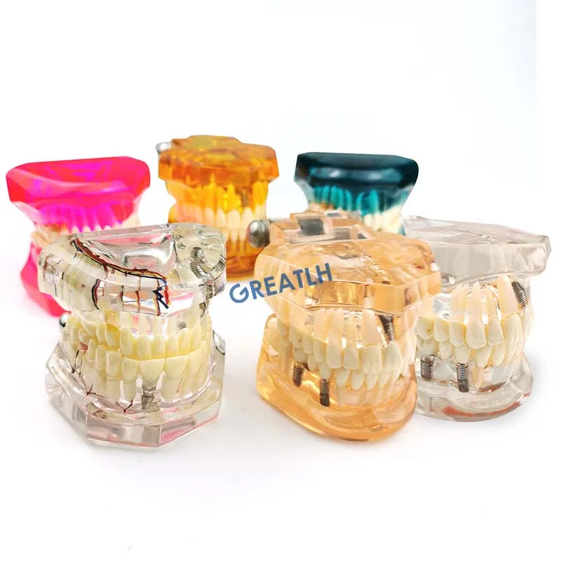 Оборудование для обучения стоматологическим заболеваниям стоматологический