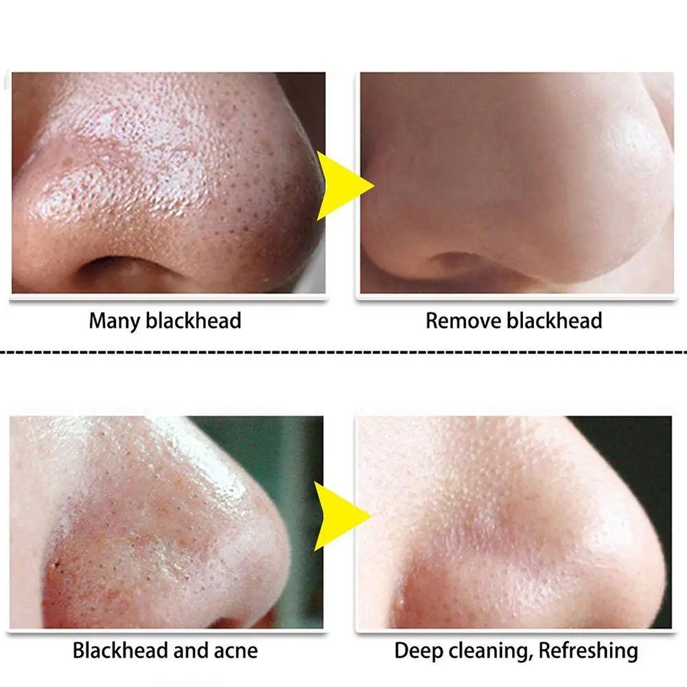 

1Pcs Nasal Mask Blackhead Acne Mask Green Tea Bamboo Patch Charcoal Nose Blackhead Shrink Pores Nose Remove Patch T1B0