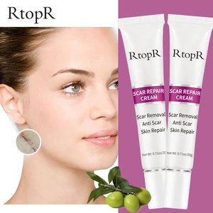 Отбеливающий крем для ухода за кожей, 2 коробки, для удаления рубцов, растяжек, акне, пятен, акне