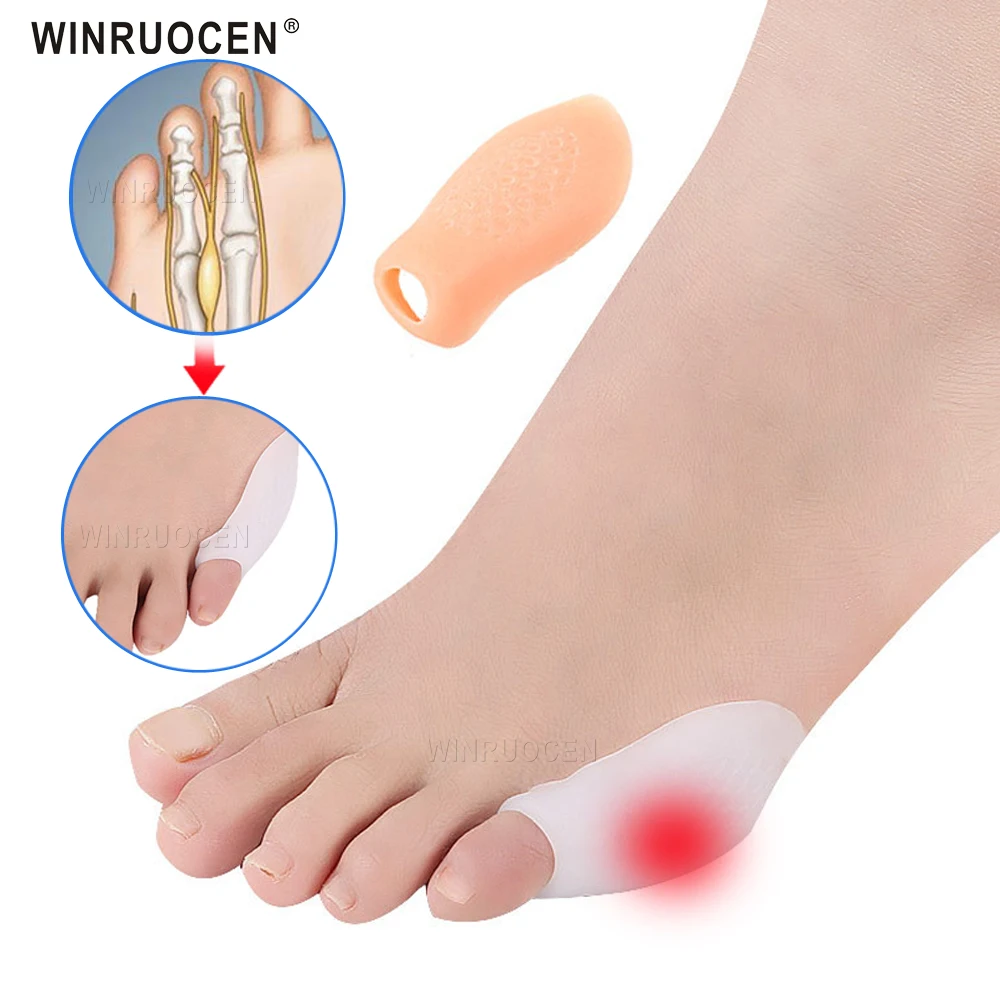 2 шт. силиконовые вставки для разделения большого пальца ноги при вальгусной