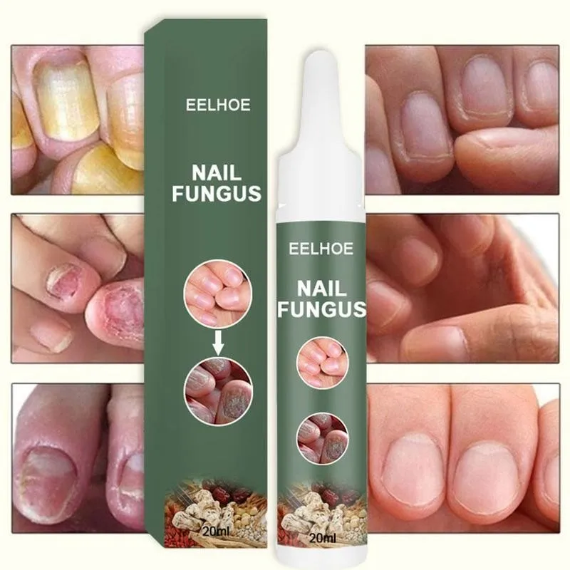 

20ml Nail Treatment Nail Art Care Fruit Flavour Manicure Exfoliate Nail Nutrition Oil Shiny Makeup Moisturizing Products So D9V9