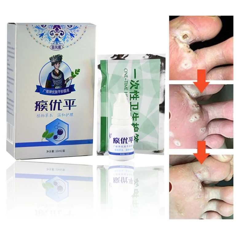 Метка на коже набор для удаления бородавок тела лечение мазь медицинский