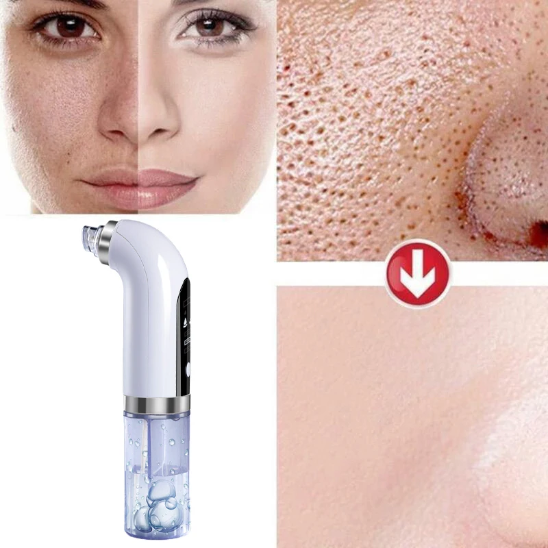 

Blackhead Remover Vacuum Electric Vacuum Bubbles Blackhead Acne Pore Cleaner Water Cycle Skin Deep Cleaning Beauty Care Devices