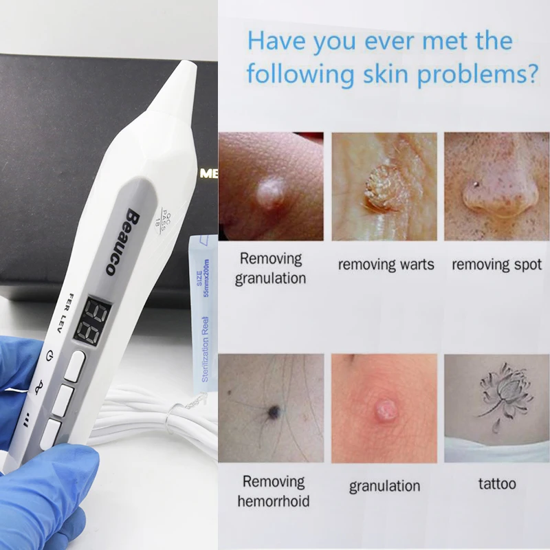 9 уровней перезаряжаемая плазменная ручка для фибробластов подтяжка век лифтинг