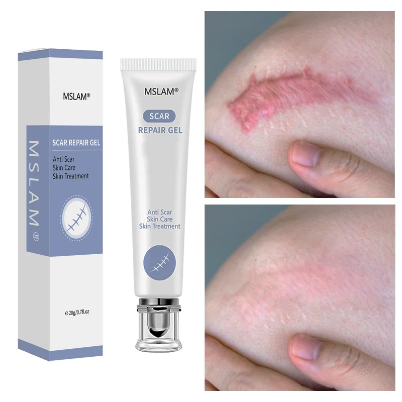 

2/1pcs MSLAM Scar Repair Gel Removal Scar Acne Cream Treatment Marks for Face Body Pigmentation Corrector Skin Cremas