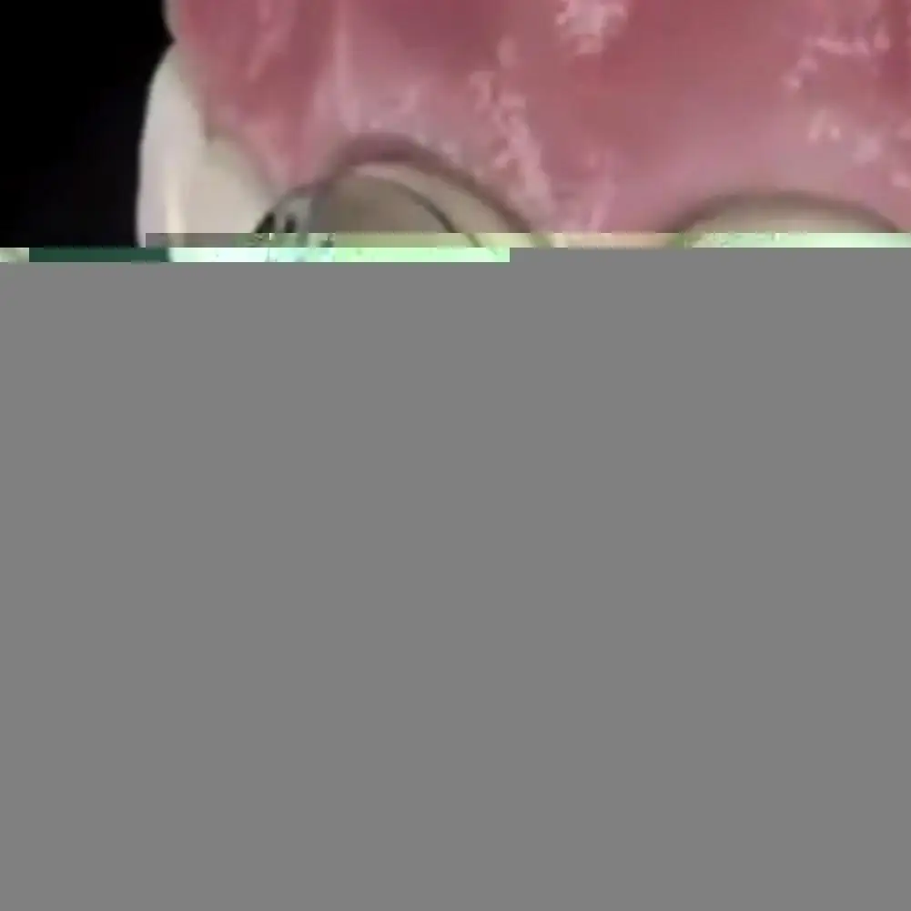 32 шт. форма для зубного шпона | Красота и здоровье