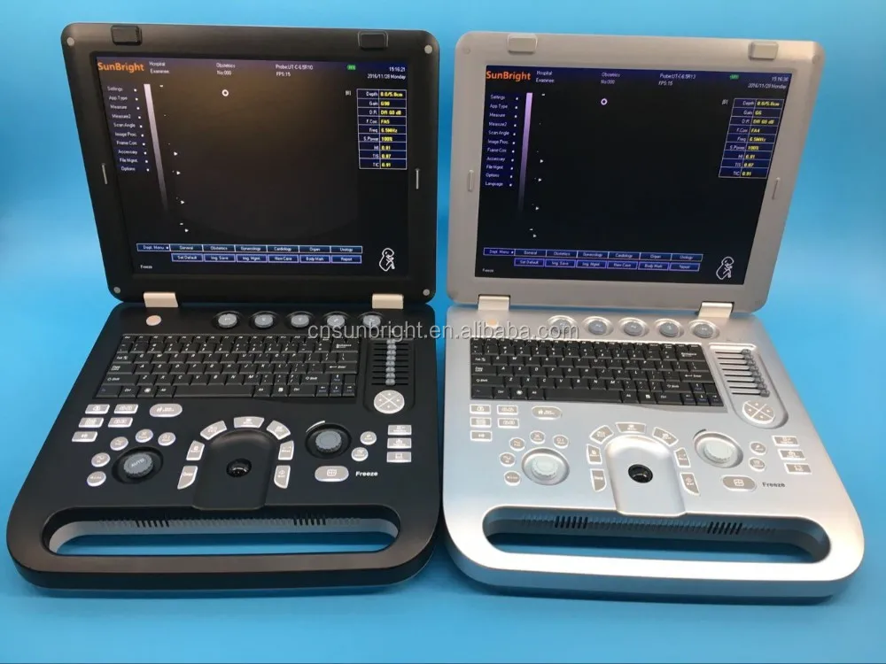 3D портативный ультразвуковой аппарат цифровое изображение ноутбук сканер |