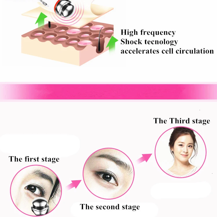 МО тюльпан Электрический массажер для глаз против старения морщин патч