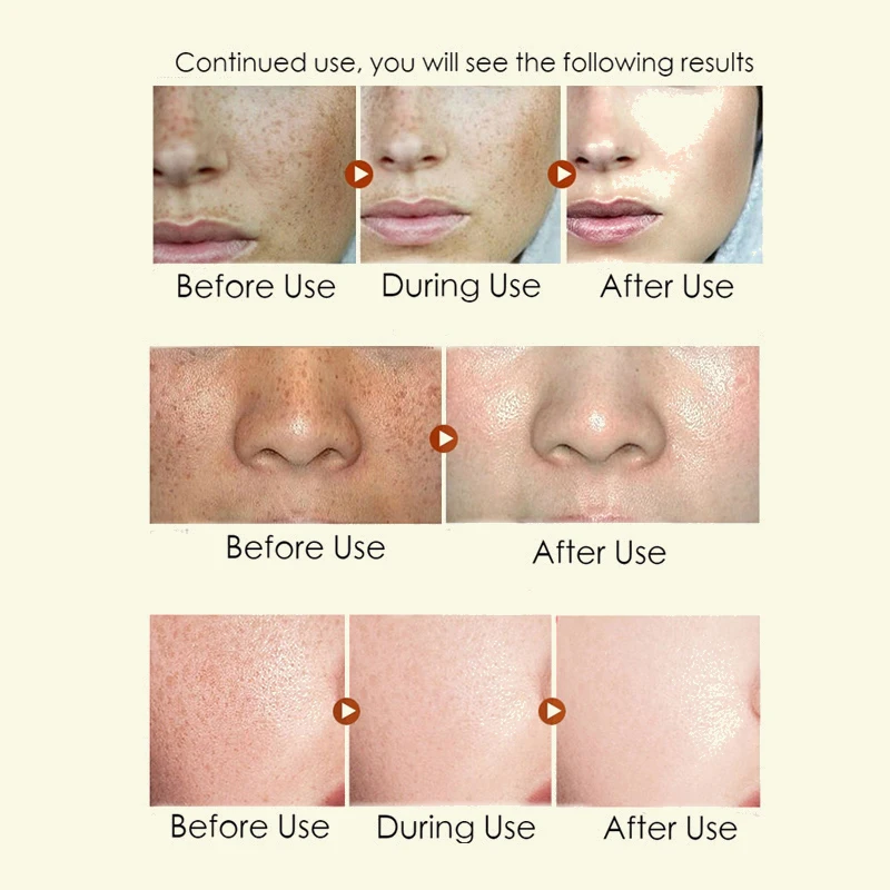 2.5% органический ретинол увлажнитель для лица крем с гиалуроновой кислотой