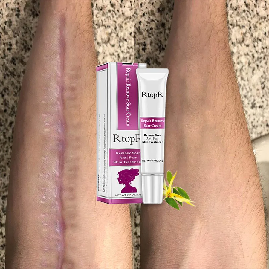 

LAIKOU Stretch Mask Scar Marks Remover Cream Skin Repair Face Cream Spots Acne Treatment Blackhead Whitening Cream Skin Care