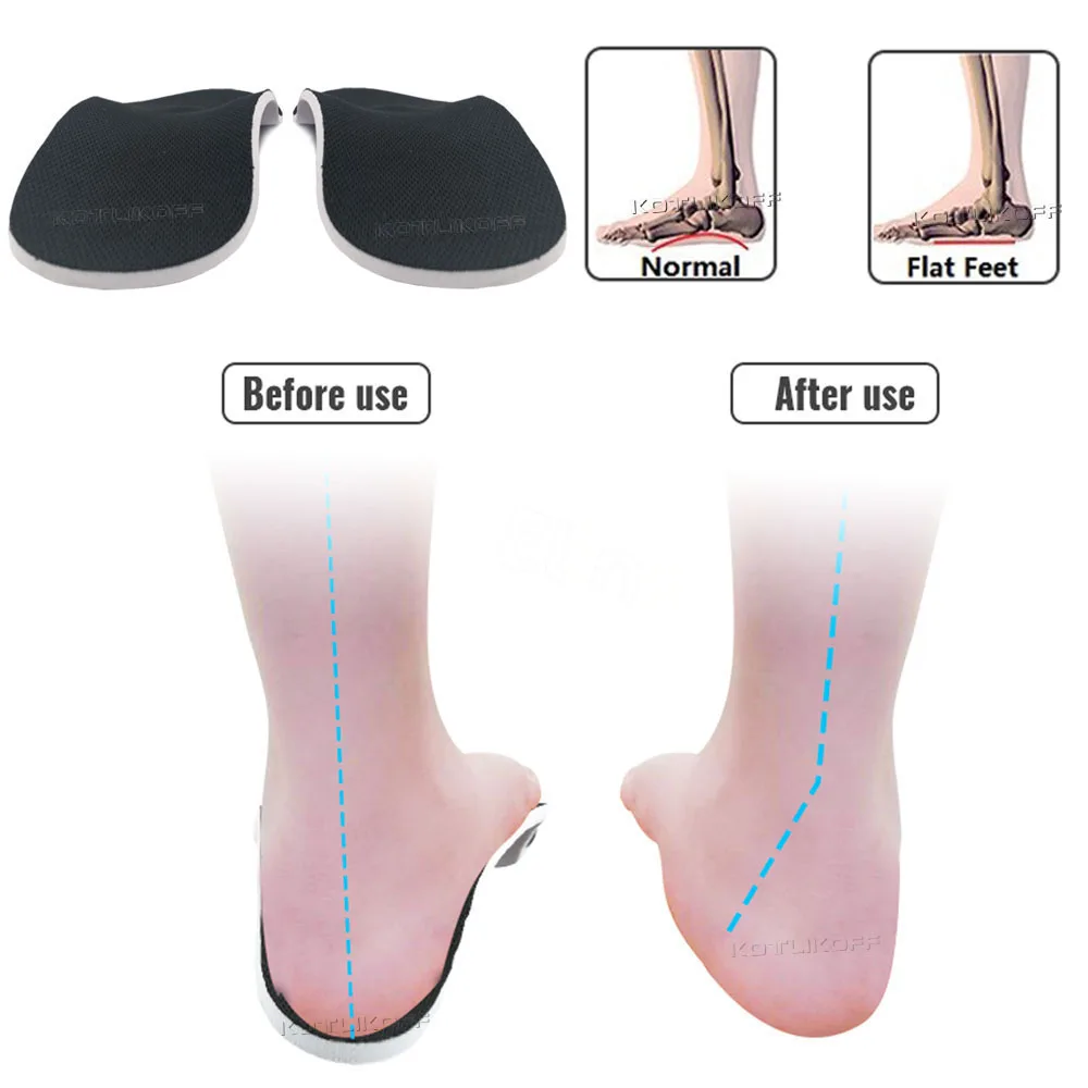 Orthotic Insoles High Arch Support Gel Pad Flat Feet Orthopedic Foot Pain Relief 3D Arch Support Insert Health Care Insoles