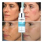 LANBENA HA Гиалуроновая кислота увлажнение кожей, очищение пор на Уход за лицом крем Black Head лечение от прыщей, отбеливание крем 15 мл