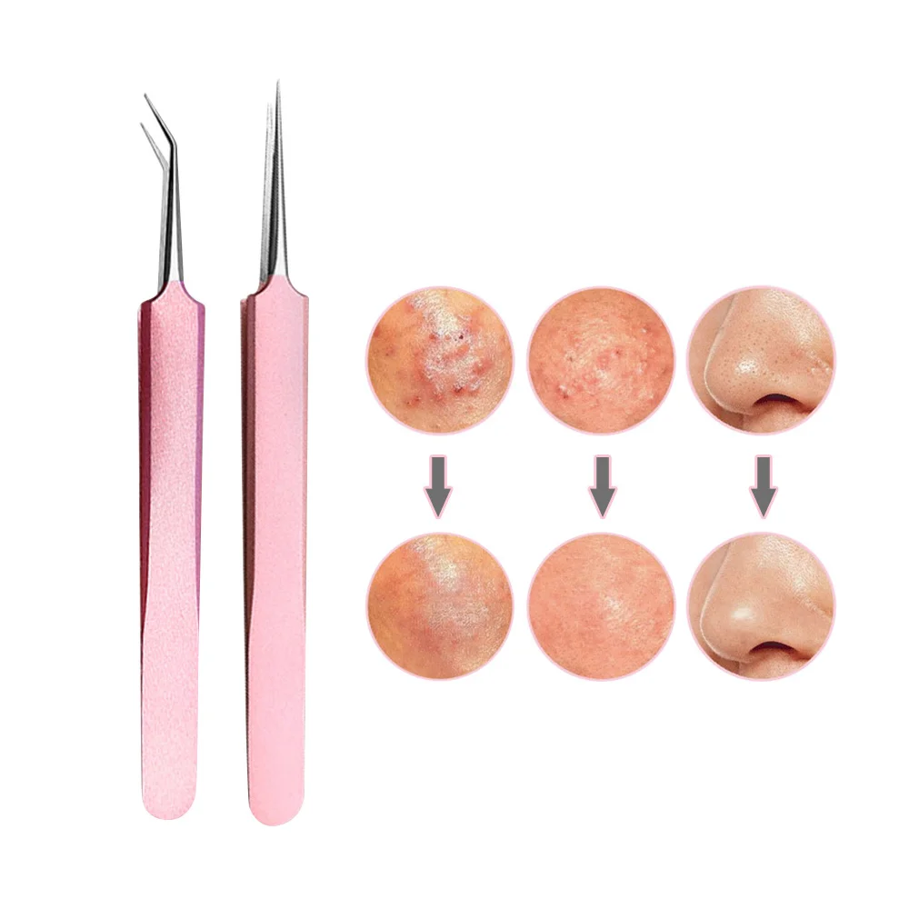 

Acne Blackhead Remover Needles Extractor Stainless Steel Pimple Blemish Comedone Clip Removal Tweezer Face Beauty Skin Care Tool