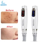 Beemyi лазерная ручка пикосекунда для удаления татуировок, лазерная ручка для удаления веснушек, машина для удаления пигментных пятен на родинках, Косметическая ручка для ухода за кожей