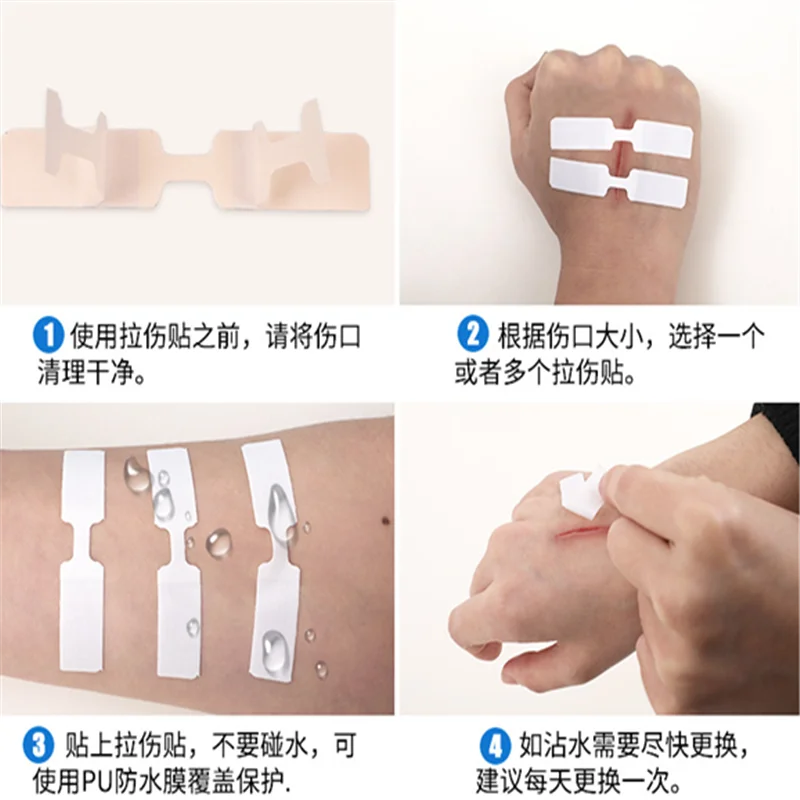 5 шт. Самоклеящиеся повязки для ран | Красота и здоровье
