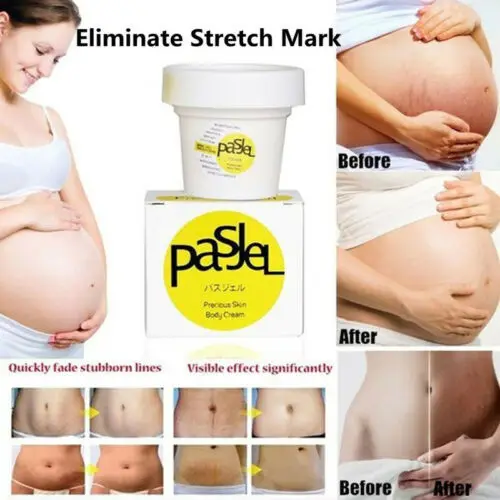 

50g Genuine Thailand Skin Body Cream Remove Stretch Marks Treatment Postpartum Repair Whitening CREAM Scar Removal Free shipping