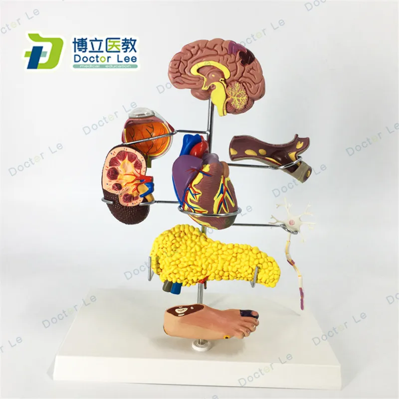 

8 частей, модель анатомии диабетических осложнений среднего размера с сердцем и ногами головного мозга для медицинского обучения и демонст...