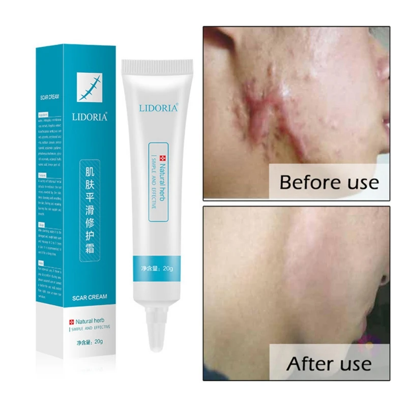 20g Hydrating Remove Pimple Marks Face Serum Skin Smoothing Cream Repair Essential Liquid
