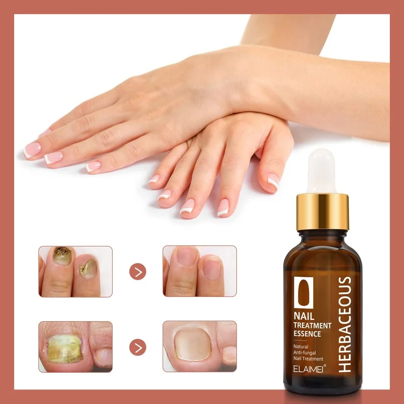 

Nail Repair Liquid Biological Repair Film Onychomycosis Repair Remover Antibacterial Liquid Whitening and Brightening Nails