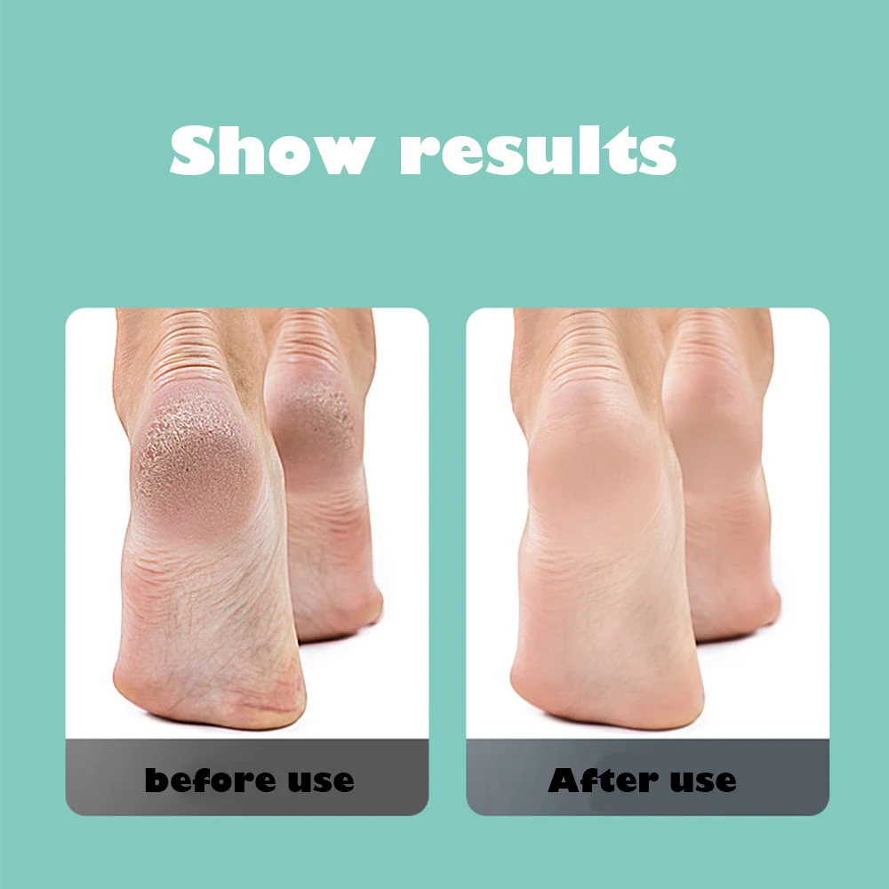 

Skin Care Tool