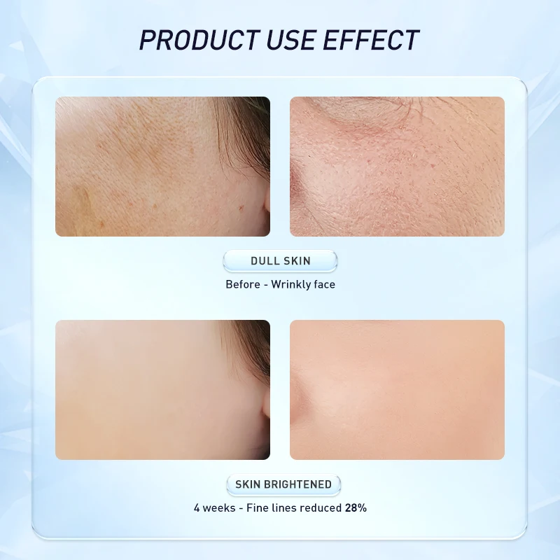 AUQUEST Retinol Face Cream Anti-Aging Wrinkle Whitening Moisturizing Improve Fine Lines Firming Lifting Facial Skin Care | Красота и