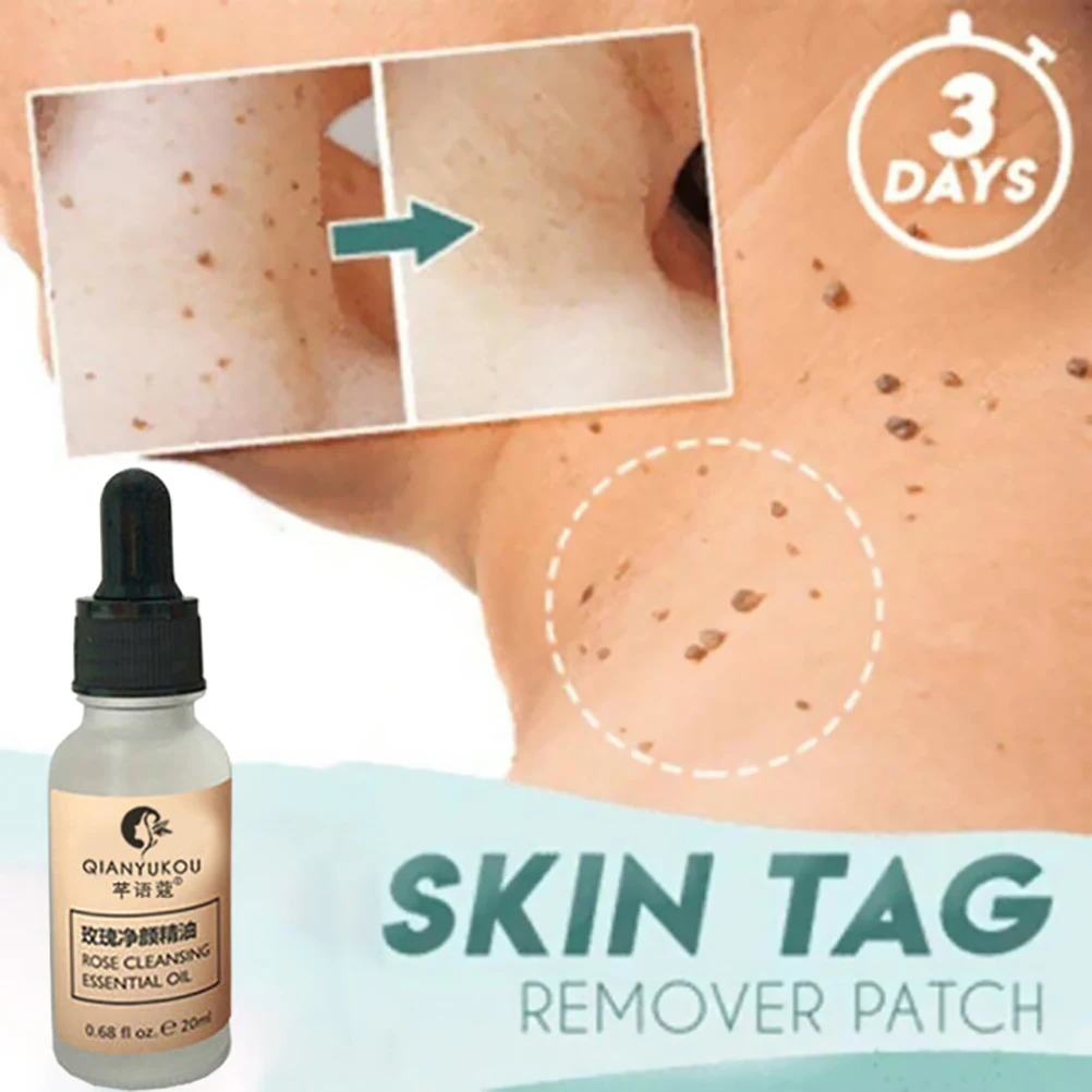 20 мл лечение генитальной деформации папилломы удаление бородавки жидкость из