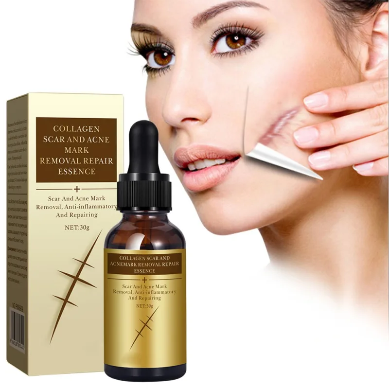 

Scar Repair Essence Skin Scar Removal Serum Collagen Skin Care Essence Fade Spot Pregnant Women Skin Care Repair Essence
