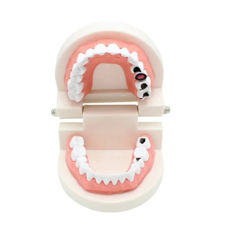 

Стоматологическая Ортодонтическая модель зубов с ортодонтической аркой, металлический кронштейн, букальная трубка, лигатурные соединения...
