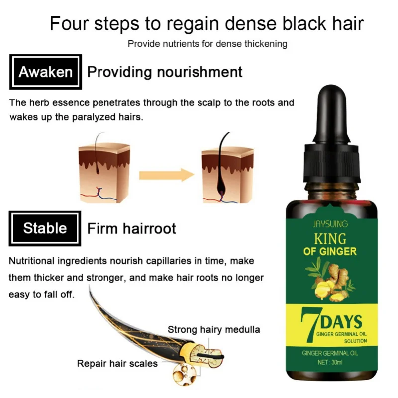 

Hair Loss Treatment Shampoo, Ginger Hair Growth Serum Refreshing Oil Control Shampoo For Thicker Hair Care Men Women