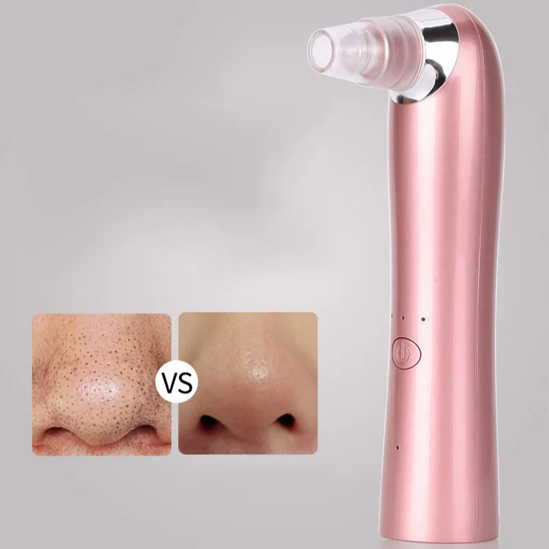 Удаление угрей удаление кожи лечение акне вакуумный аппарат для очистки пор