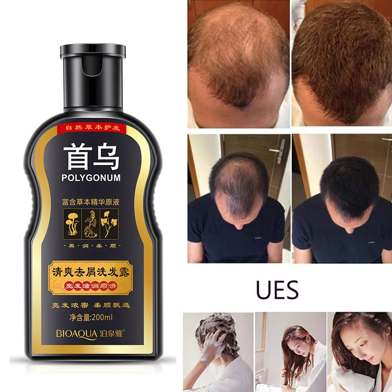 БИОАКВА Шампунь против перхоти Полигонум Мультифлорум Питательный Уфа Китайский травяной рост волос и ремонт поврежденных грубых сухих.