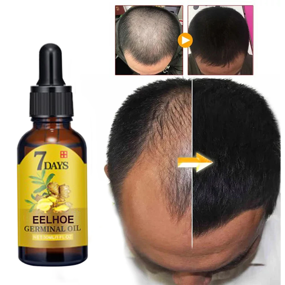 

Eelhoe Hair Growth Essence Hair Loss Scalp Treatments Ginger Ginseng Raise Dense Hair For Damaged Hair SANA889