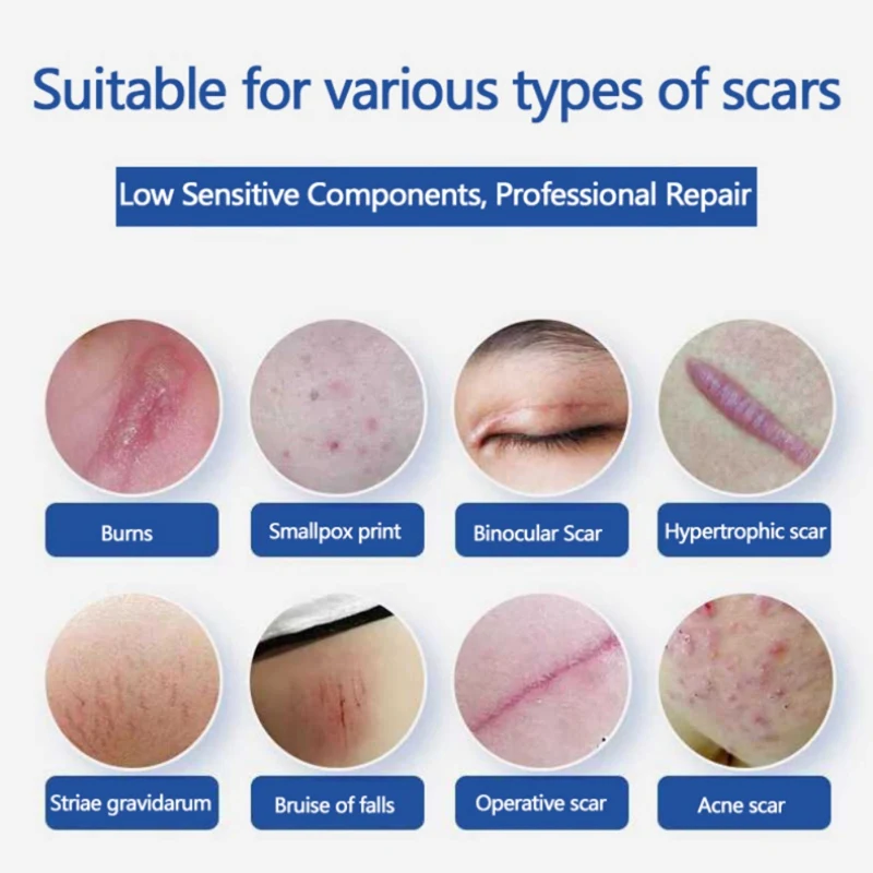 20g Hydrating Remove Pimple Marks Face Serum Skin Smoothing Cream Repair Essential Liquid