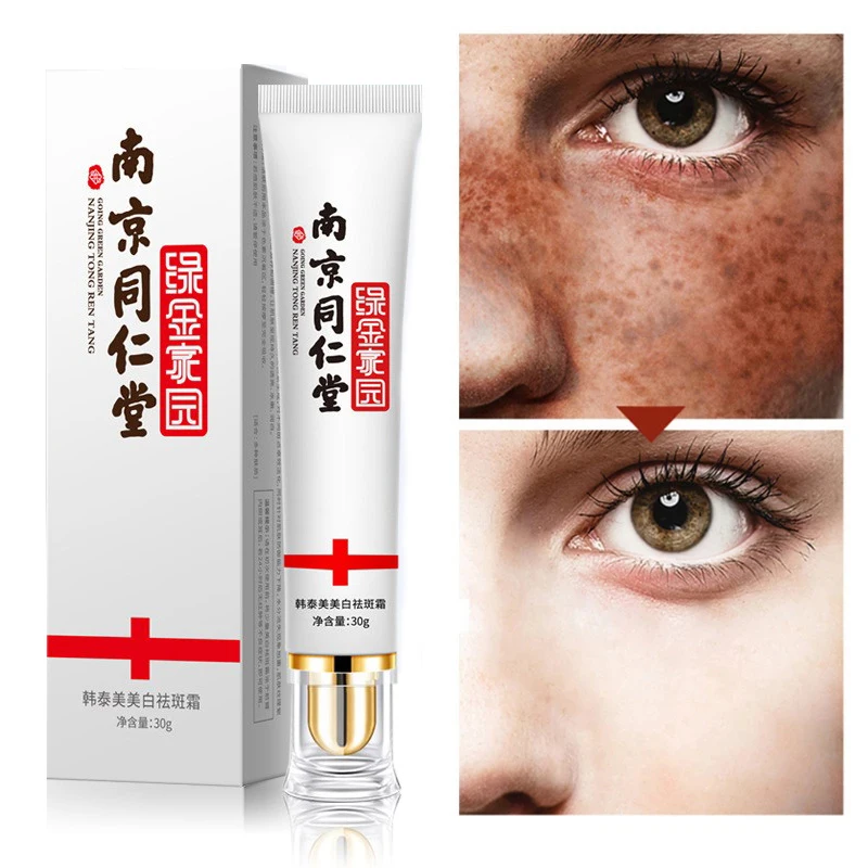 

Whitening and anti-freckle cream to remove chloasma acne spots melanin dark spots pigmentation moisturizing gel skin care