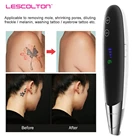 Аппарат для удаления татуировок, лазерный аппарат для удаления пикосекунды, веснушек, темных пятен, бровей, аппарат для ухода за красотой