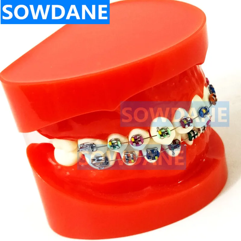 Стоматологическая Ортодонтическая обучающая модель с ортодонтическим