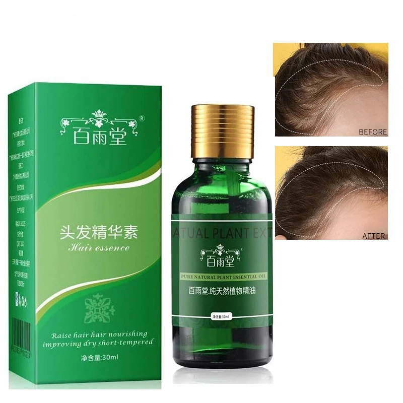 Hair Care Hair Growth Essential Oils Essence Original Authentic 100% Hair Loss Liquid Health Care Beauty Dense Hair Growth Serum